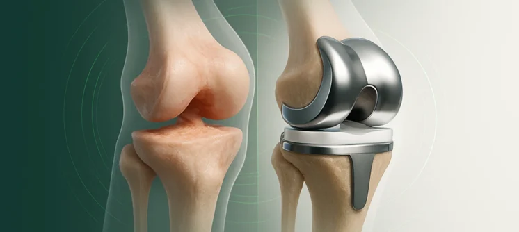 assets_task_01k246qq6ferdvedbmyjkbfn38_1754635467_img_0